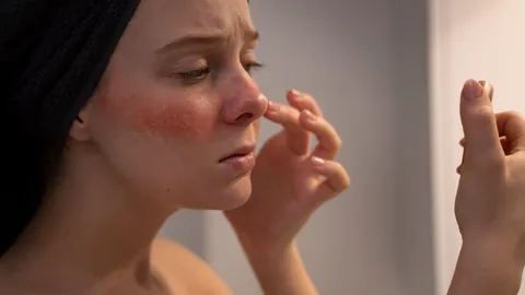 5 hábitos que dañan tu piel y no lo sabías