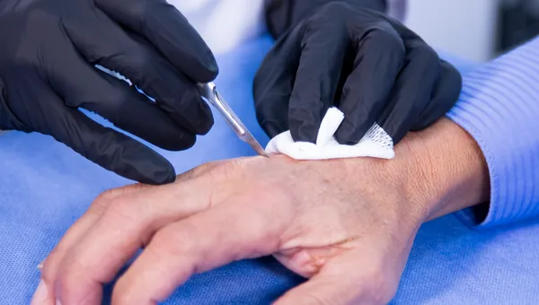 Procedimientos quirúrgicos dermatológicos